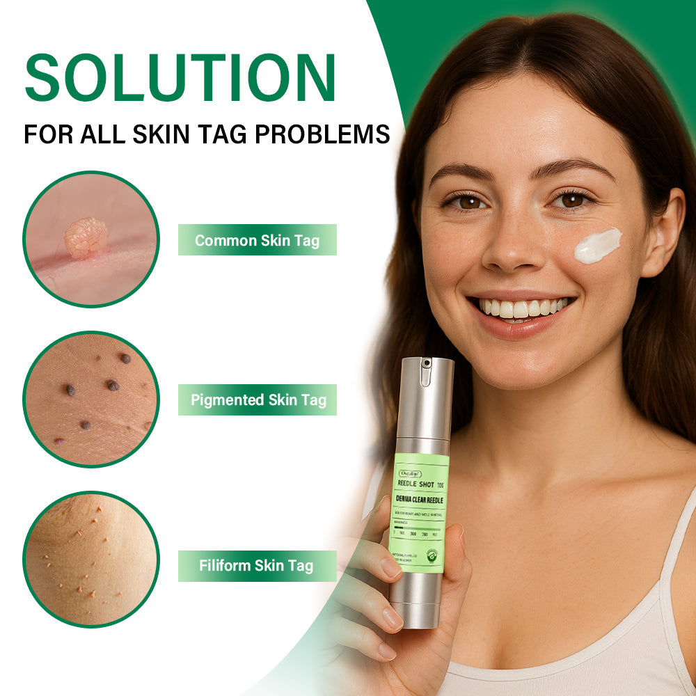 Korean DermaClear Reedle Shot 100 Wart & Mole Eraser Serum