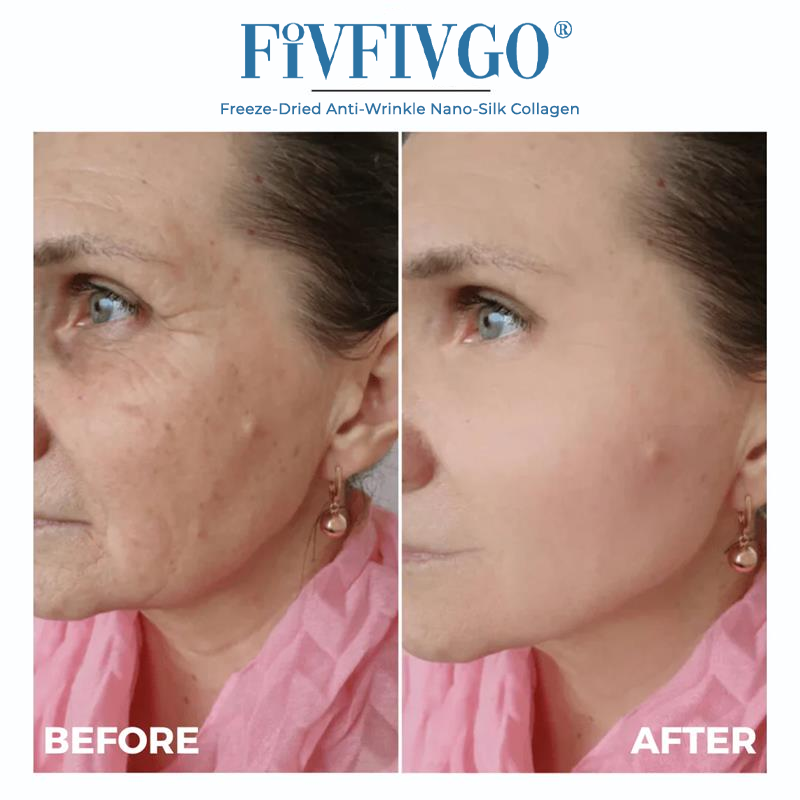 Freeze-Dried Anti-Wrinkle Nano-Silk Collagen