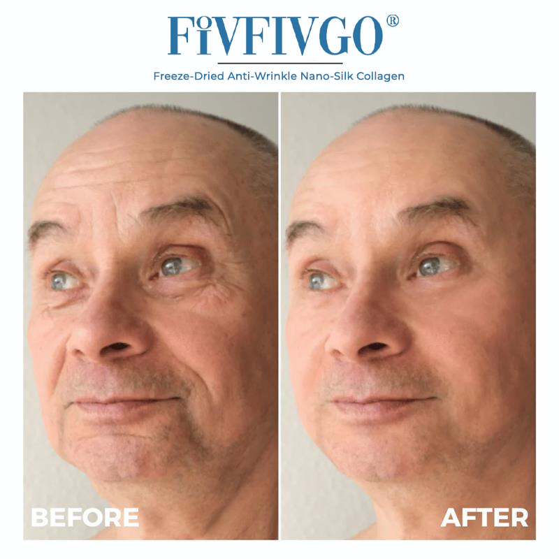 Freeze-Dried Anti-Wrinkle Nano-Silk Collagen
