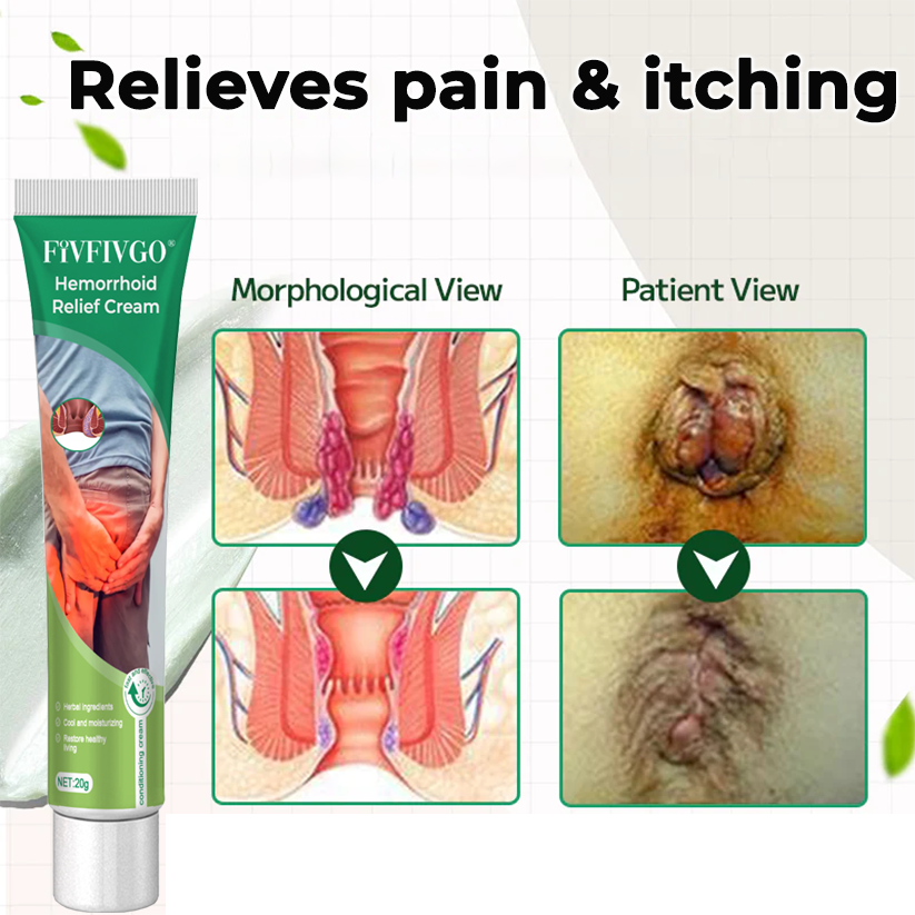 Hemorrhoid Relief Cream