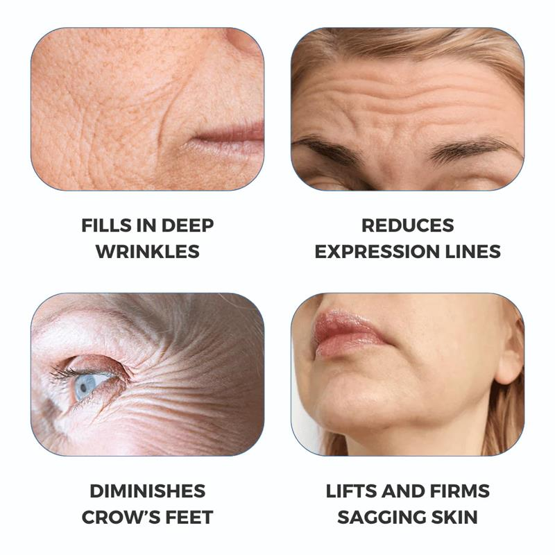 Freeze-Dried Anti-Wrinkle Nano-Silk Collagen
