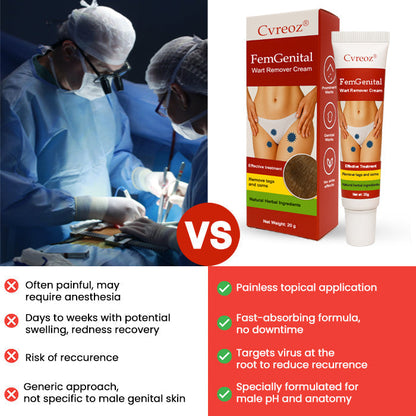 FemGenital Wart Remover Cream
