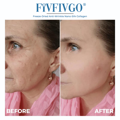 Freeze-Dried Anti-Wrinkle Nano-Silk Collagen
